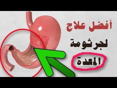 بكتريا المعدة , افضل علاج لجرثومه المعده