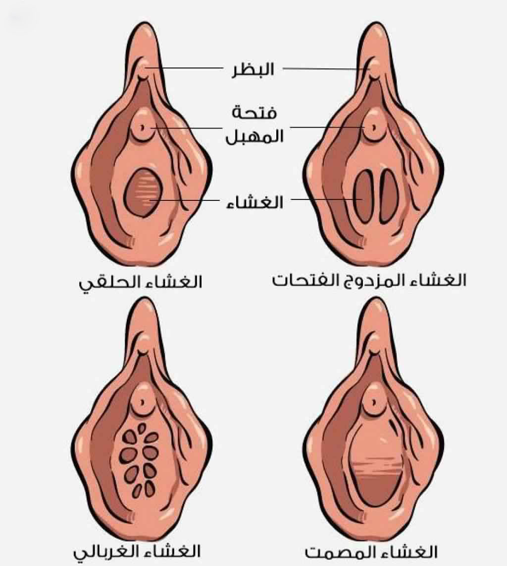 غشاء بكارة سليم حقيقي ، صور مهمة للغشاء البكارة السليم 12934