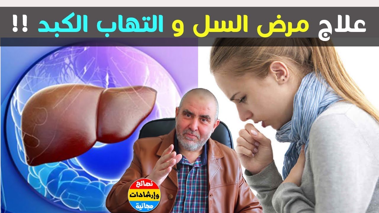 علاج مرض السل - كيف يتم العلاج لمرض السل والوقاية منه - 4035 4