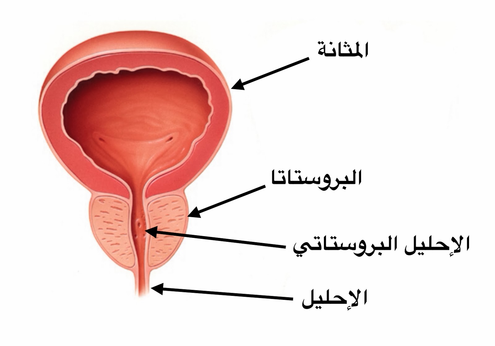 علاج تضخم البروستاتا - كيف اتخلص من تضخم البروستاتا 343 1