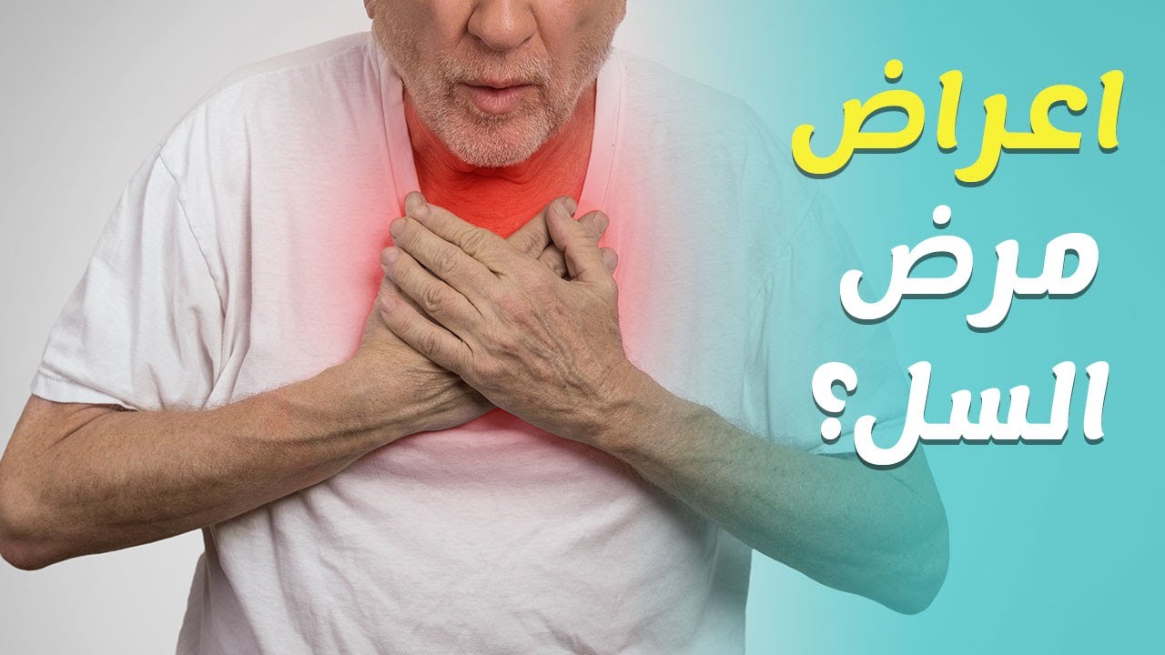 علاج مرض السل - كيف يتم العلاج لمرض السل والوقاية منه - 4035 7