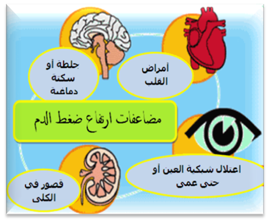 اسباب ارتفاع ضغط الدم , ما الذي يؤدي لارتفاع ضغط الدم ؟