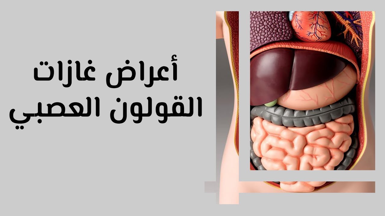 علاج الغازات في البطن 12093 6