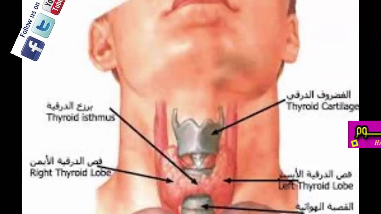 اعراض قصور الغدة الدرقية , المضاعفات الخطيره للقصور الغدة الدرقيه