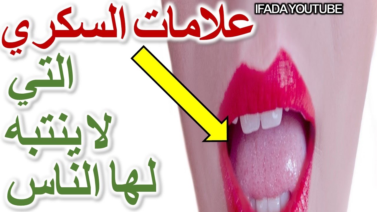 اعراض مرض السكر - اسباب امراض السكر عند الاطفال 2015 1