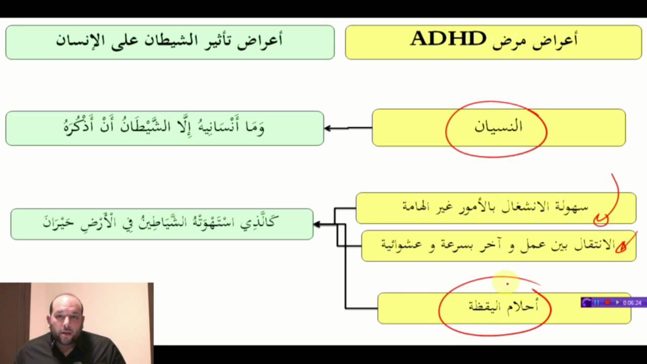 اسباب قلة التركيز والنسيان 12229 3