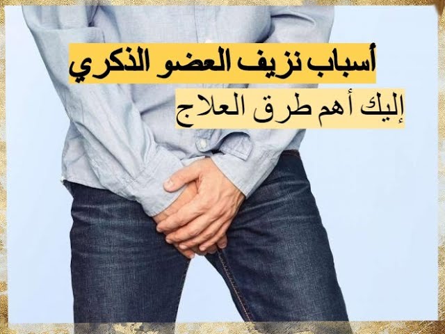 علاج خروج صديد من الذكر ,  افدونى هل يوجد علاج لخروج الصديد من الذكر !!