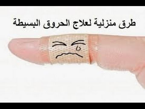 علاج الحروق , اقوي علاج للحروق